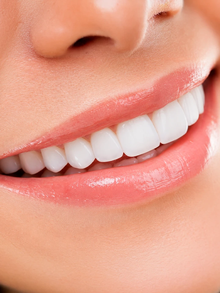 Transformação estética do sorriso